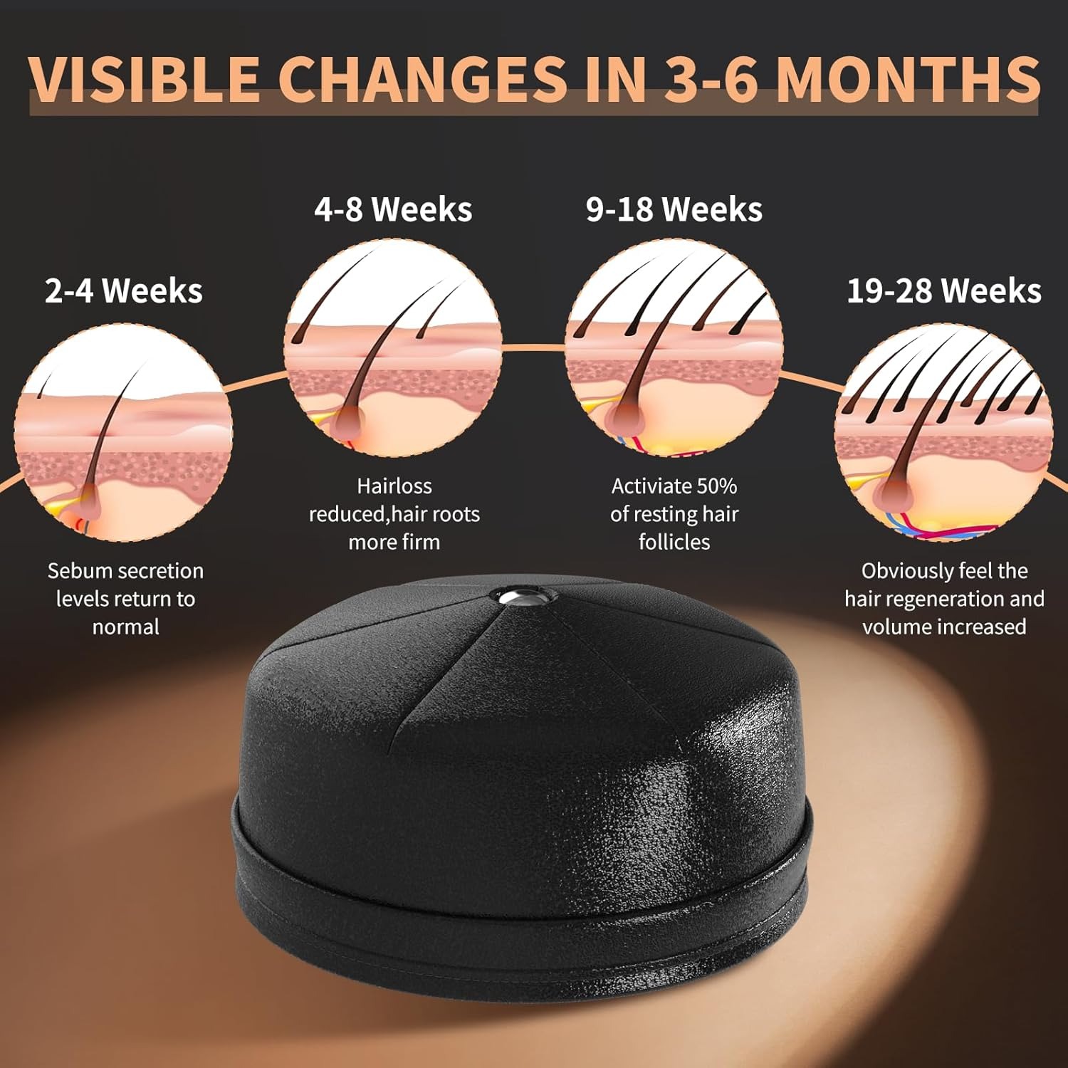 Nuovo Casco Laser per la Cresc - Hair Care Basic recensione e prezzo